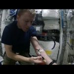 Tim Peake: how to draw blood in space