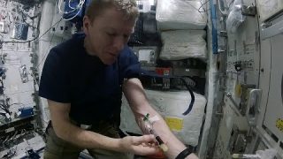 Tim Peake: how to draw blood in space